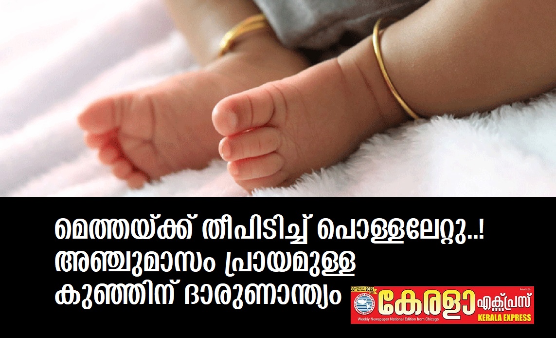 blog image
